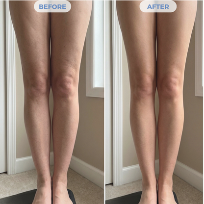 AuraSculpt Pro™ Deep Relief System